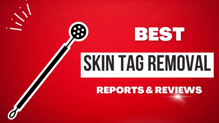 Best Skin Tag Removal Consumer Reviews And Reports