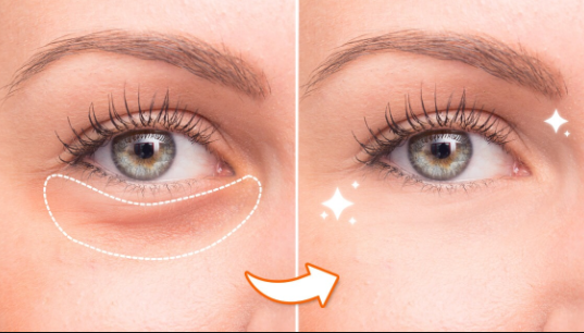 How To Get Rid Of Under Eye Bags & Puffy Eyes
