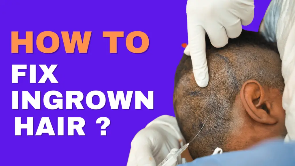 How To Fix Ingrown Hair?