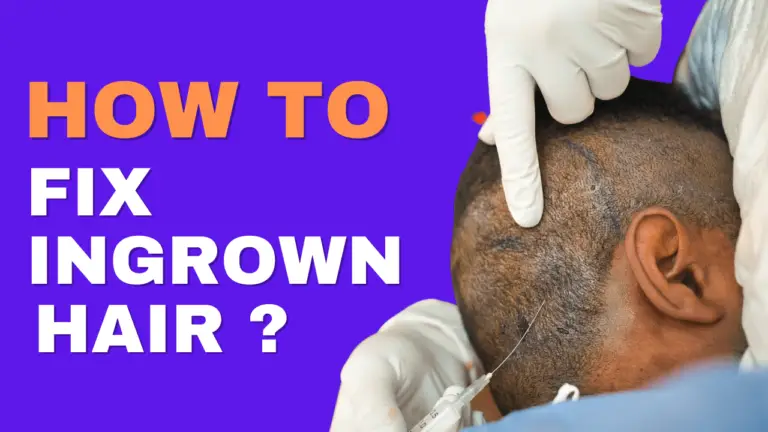 How To Fix Ingrown Hair?